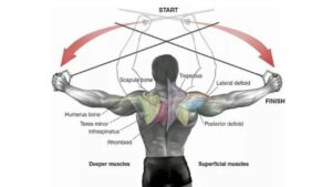 Cable Crossovers , An exercise for gynecomastia. 