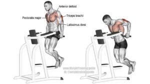 Chest Dips an exercise effective for gynecomastia. 